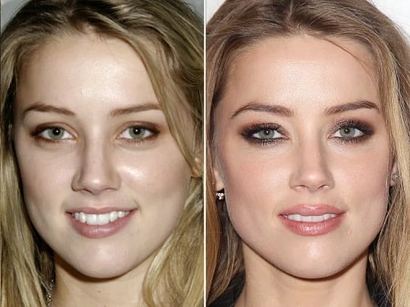 A picture of Amber Heard before (left) and after (right).